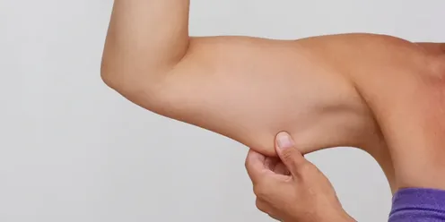 Flacidez de la piel